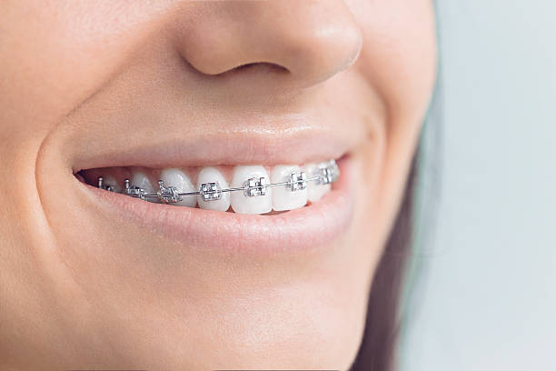 Best Dental Fillings (Composite and Amalgam)  in Derby, KS